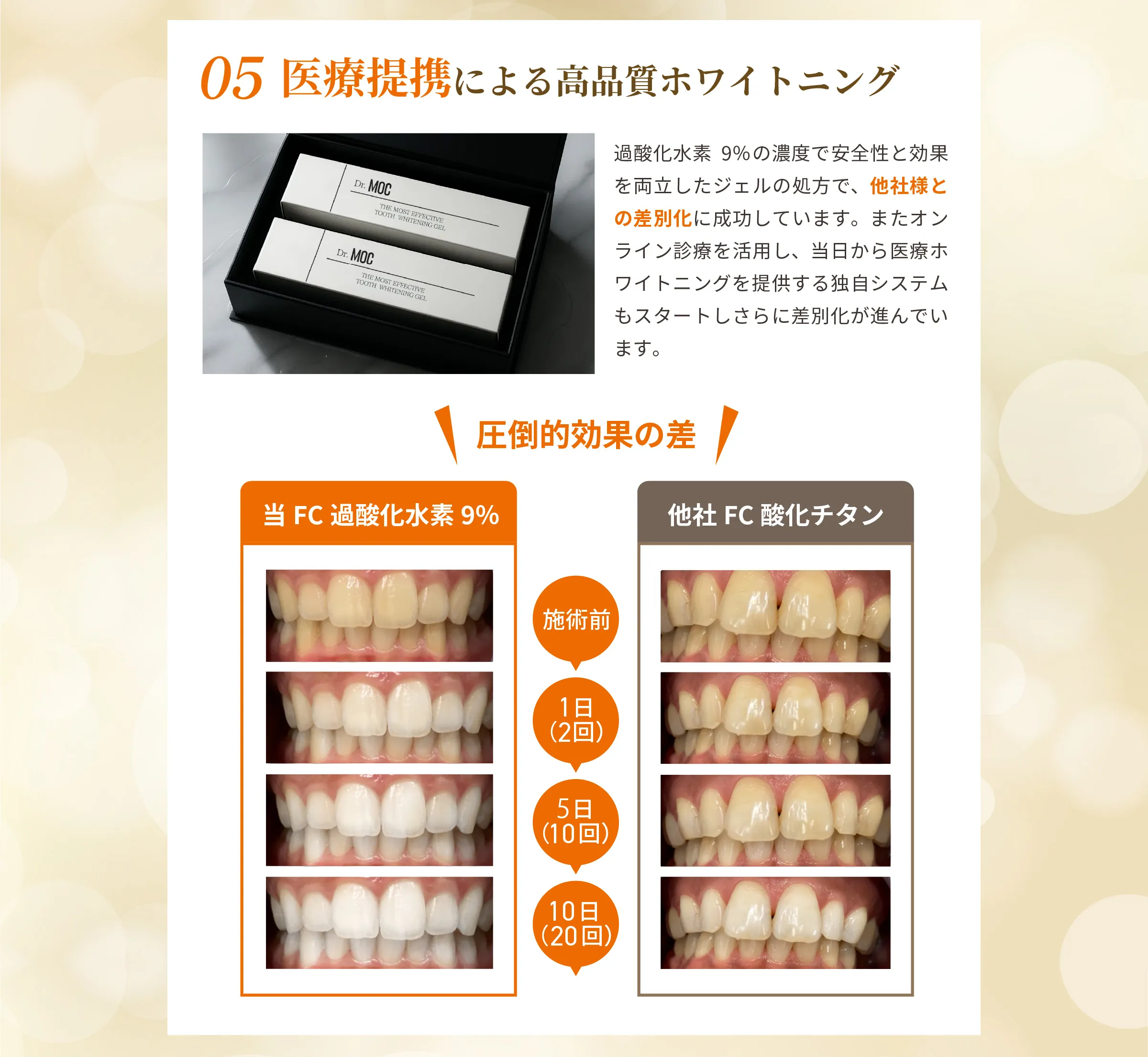 医療提携による高品質ホワイトニング