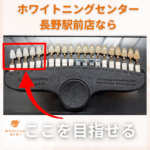 長野市にあるホワイトニングセンター長野駅前店なら目指せる色がわかるシェードガイドの写真