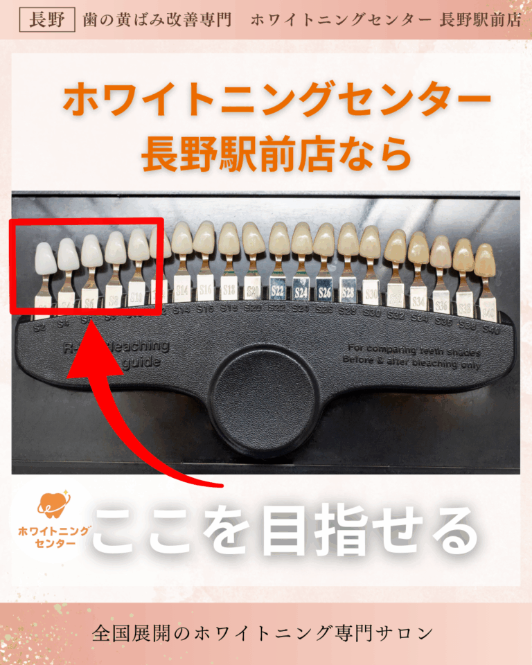 長野市にあるホワイトニングセンター長野駅前店なら目指せる色がわかるシェードガイドの写真