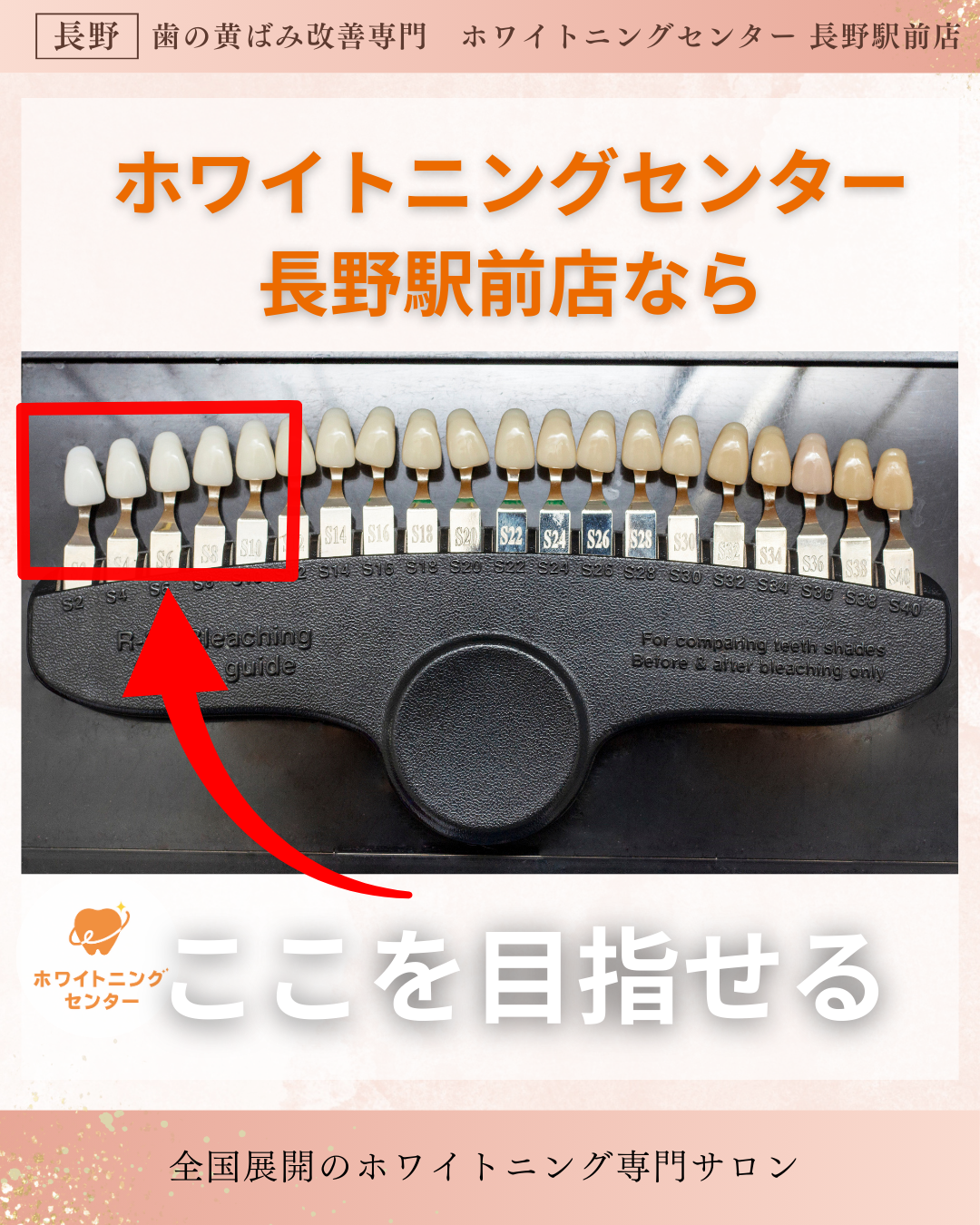 長野市にあるホワイトニングセンター長野駅前店なら目指せる色がわかるシェードガイドの写真