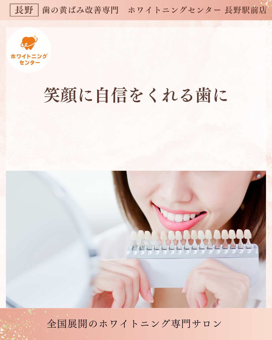 長野市の長野駅前にあるホワイトニングセンターで歯の着色の悩みを解消する写真
