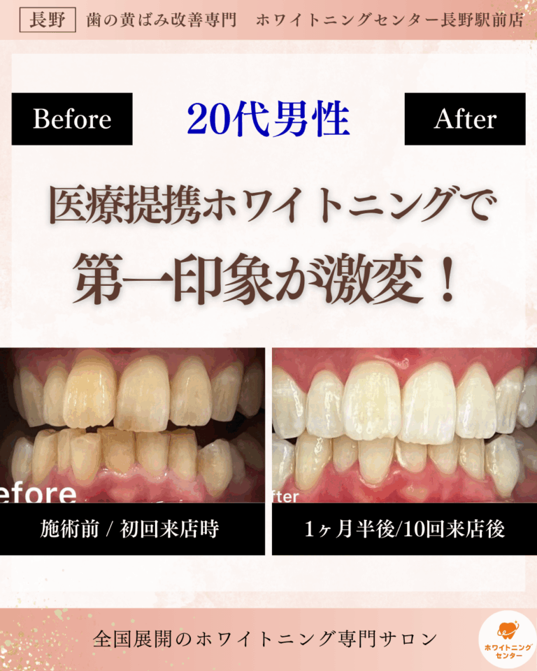 長野市にあるホワイトニングセンター長野駅前店で医療提携ホワイトニングを受け第一印象が激変した男性のビフォーアフター写真