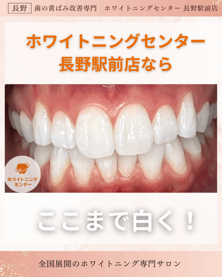 長野市のホワイトニングセンター長野駅前店で医療提携ホワイトニングを受けて、ここまで白くなった写真