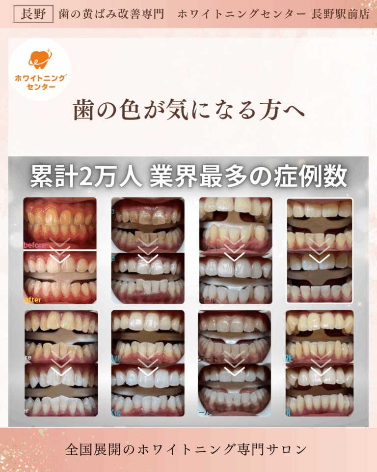 長野市にあるホワイトニングセンター 長野駅前店で医療提携ホワイトニングをして歯が白くなったお客様のビフォーアフター症例写真