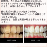 長野駅前のホワイトニングサロンによる2025年の実績。30代男性の人生を変えた約2ヶ月半での変化。短期間で歯が白くなる成功事例。